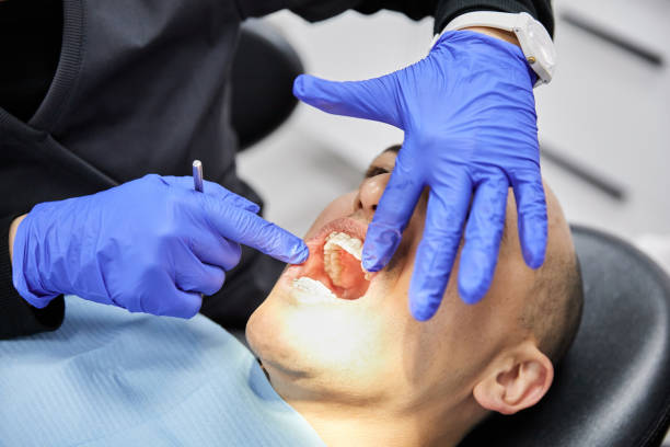 Best Emergency Dentist for Lost Fillings or Crowns in Bloomingdale, NJ